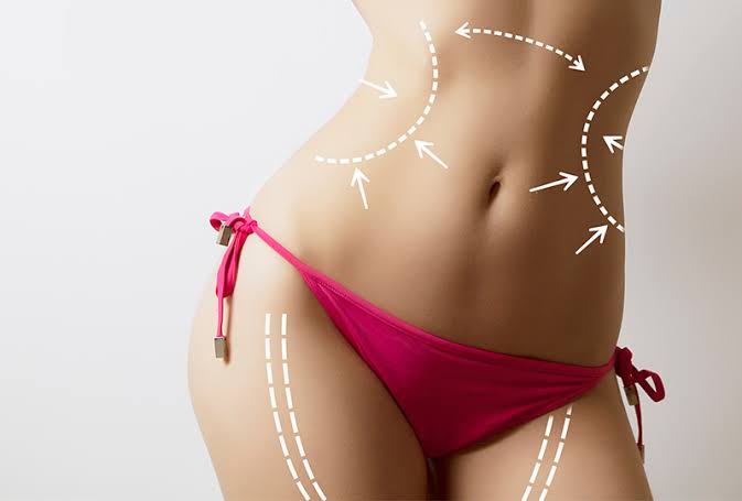 liposuction surgery in delhi